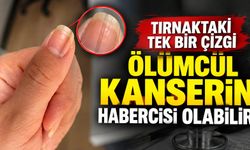 Tırnaktaki tek bir çizgi ölümcül kanserin habercisi olabilir