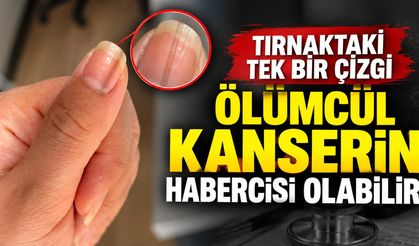 Tırnaktaki tek bir çizgi ölümcül kanserin habercisi olabilir